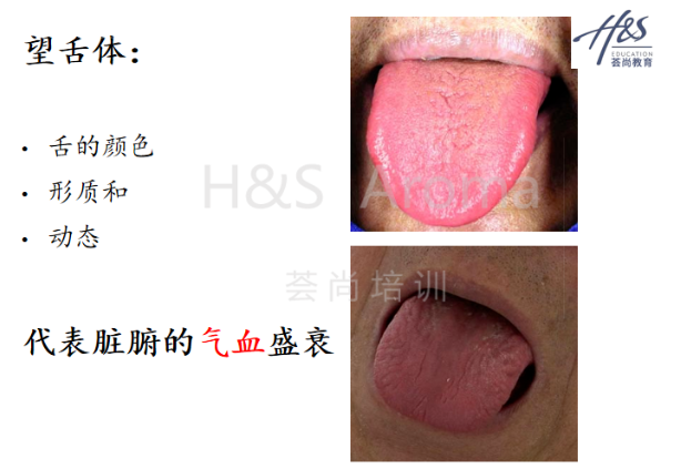 清远中医芳疗培训：望闻问切之舌诊专题课程