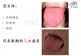 中医芳疗培训：望闻问切之舌诊专题课程