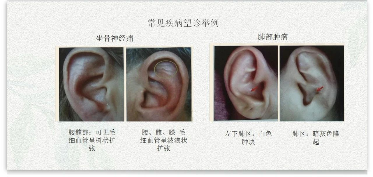 耳朵色泽形状软硬穴位位置等中医原理辩证诊断课程.jpg
