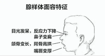 IFA认证芳疗师培训作业之腺体肿大体面特征